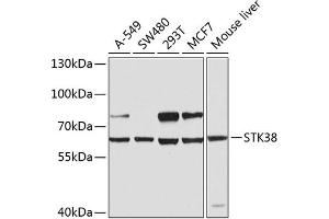 Western blot analysis of extracts of various cell lines, using STK38 antibody (ABIN6132692, ABIN6148616, ABIN6148617 and ABIN6224215) at 1:1000 dilution. (STK38 anticorps  (AA 1-200))