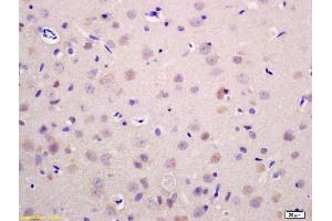 Formalin-fixed and paraffin embedded rat brain labeled with Anti-RAB21 Polyclonal Antibody, Unconjugated (ABIN758516) at 1:200 followed by conjugation to the secondary antibody and DAB staining. (RAB21 anticorps  (AA 51-150))