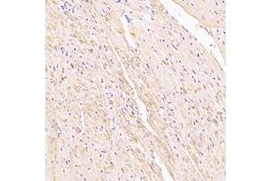 Immunohistochemistry analysis of paraffin-embedded rat heart using,Myoz2 (ABIN7074744) at dilution of 1: 6000 (MYOZ2 anticorps)