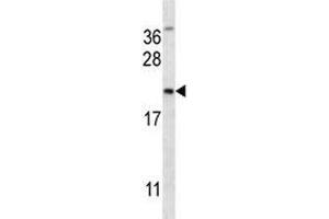 MUC-1 antibody western blot analysis in NCI-H292 lysate.