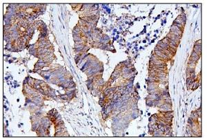 IHC analysis of CDC42 using anti-CDC42 antibody (ABIN6719528).