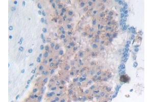 Detection of GaA in Mouse Cerebrum Tissue using Polyclonal Antibody to Glucosidase Alpha, Acid (GaA)