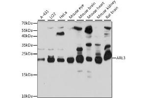 Western blot analysis of extracts of various cell lines, using  antibody (ABIN7265493) at 1:1000 dilution.