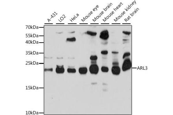 ARL3 抗体  (AA 1-182)