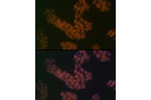 Immunofluorescence analysis of HeLa cells using B Rabbit mAb (ABIN7265826) at dilution of 1:100 (40x lens).