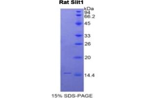 SDS-PAGE of Protein Standard from the Kit (Highly purified E. (SLIT1 Kit ELISA)