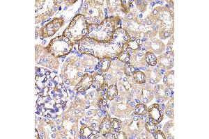 Immunohistochemistry of paraffin-embedded rat kidney using PPL antibody at dilution of 1:100 (x400 lens). (PPL anticorps)