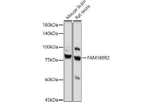 Western blot analysis of extracts of various cell lines, using FB2 antibody (ABIN7267112) at 1:1000 dilution.