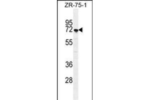 SUSD5 Antibody (C-term) (ABIN655447 and ABIN2844977) western blot analysis in ZR-75-1 cell line lysates (35 μg/lane). (SUSD5 anticorps  (C-Term))