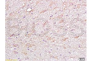 Formalin-fixed and paraffin embedded rat brain labeled Anti-FGFR4 Polyclonal Antibody, Unconjugated (ABIN671766) at 1:200, followed by conjugation to the secondary antibody and DAB staining (FGFR4 anticorps  (AA 1-100))