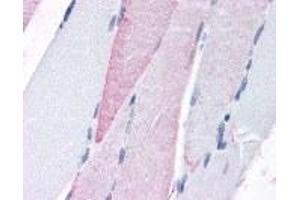 Immunohistochemistry (IHC) image for anti-G Protein-Coupled Receptor, Family C, Group 6, Member A (GPRC6A) (N-Term) antibody (ABIN2469306)