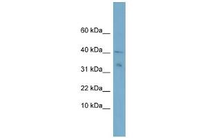 WB Suggested Anti-NDUFV3 Antibody Titration:  0. (NDUFV3 anticorps  (Middle Region))
