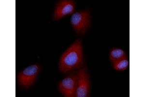 Immunofluorescence (IF) image for anti-Dipeptidyl-Peptidase 4 (DPP4) (AA 39-766) antibody (APC) (ABIN5566982)