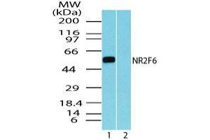 Image no. 1 for anti-Nuclear Receptor Subfamily 2, Group F, Member 6 (NR2F6) (AA 20-70) antibody (ABIN960291)