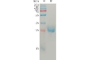 Human AN(275-496) Protein, His Tag on SDS-PAGE under reducing condition.