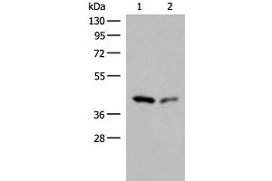 Western blot analysis of Hela and HEPG2 cell lysates using GIPC1 Polyclonal Antibody at dilution of 1:400 (GIPC1 anticorps)