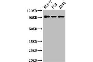 Western Blot Positive WB detected in: MCF-7 whole cell lysate, PC-3 whole cell lysate, A549 whole cell lysate All lanes: AMPD1 antibody at 3 μg/mL Secondary Goat polyclonal to rabbit IgG at 1/50000 dilution Predicted band size: 91, 90 kDa Observed band size: 91 kDa (AMPD1 anticorps  (AA 97-272))