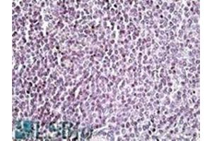 AP22454PU-N AIM2 antibody staining of paraffin embedded Human Spleen at 3. (AIM2 anticorps  (C-Term))