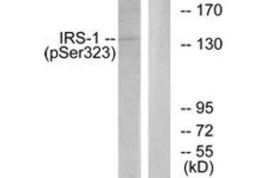 Western blot analysis of extracts from COS7 cells treated with Serum 20% 15', using IRS-1 (Phospho-Ser323) Antibody. (IRS1 anticorps  (pSer323))