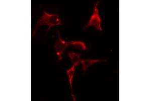 ABIN6274809 staining Hela cells by IF/ICC. (LPCAT2 anticorps  (N-Term))