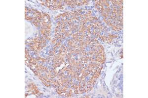 Immunohistochemistry of paraffin-embedded rat ovary using PI3 Kinase p85 beta antibody (ABIN7269320) at dilution of 1:200 (40x lens). (PIK3R2 anticorps)