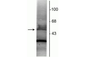 Western blot of rat hippocampal lysate showing specific immunolabeling of the ~48 kDa RAR-α protein. (Retinoic Acid Receptor alpha anticorps  (N-Term))