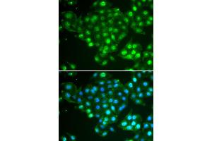 Immunofluorescence analysis of HeLa cells using ABCA3 antibody (ABIN5974136). (ABCA3 anticorps)