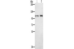 Western Blotting (WB) image for anti-Outer Dense Fiber of Sperm Tails 2 (ODF2) antibody (ABIN2430582) (ODF2 anticorps)