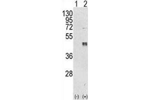Western blot analysis of CEBPB antibody and 293 cell lysate either nontransfected (Lane 1) or transiently transfected with the CEBPB gene (2). (CEBPB anticorps  (AA 271-298))