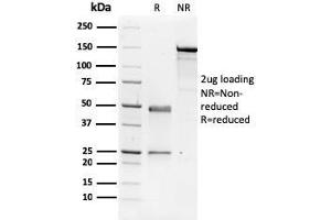 SDS-PAGE Analysis Purified NME1 / nm23-H1 Mouse Monoclonal Antibody (CPTC-NME1-2). (NME1 anticorps)