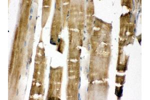 Anti- MEK3 Picoband antibody, IHC(P) IHC(P): Rat Skeletal Muscle Tissue