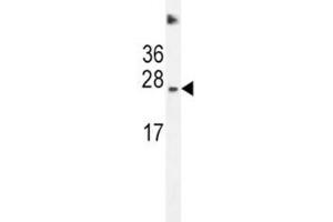 SDHD antibody western blot analysis in HeLa lysate