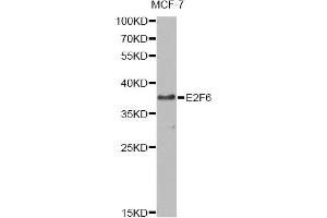 Western blot analysis of extracts of MCF-7 cells, using E2F6 antibody. (E2F6 anticorps)