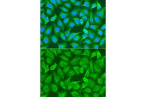 Immunofluorescence analysis of A549 cell using RRM1 antibody. (RRM1 anticorps)