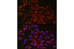 Immunofluorescence analysis of NIH/3T3 cells using P4H Rabbit pAb (ABIN1681193, ABIN3018745, ABIN3018746 and ABIN6220566) at dilution of 1:50 (40x lens).