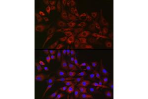 Immunofluorescence analysis of NIH/3T3 cells using P4H Rabbit pAb (ABIN1681193, ABIN3018745, ABIN3018746 and ABIN6220566) at dilution of 1:50 (40x lens). (P4HA2 anticorps  (AA 234-533))