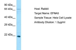 Western Blotting (WB) image for anti-Ephrin A5 (EFNA5) (N-Term) antibody (ABIN2790146) (Ephrin A5 anticorps  (N-Term))