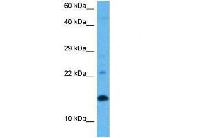 Host:  Rat  Target Name:  UBE2D1  Sample Tissue:  Rat Skeletal Muscle  Antibody Dilution:  1ug/ml (UBE2D1 anticorps  (Middle Region))