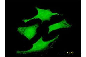 Immunofluorescence of purified MaxPab antibody to RAB6IP1 on HeLa cell.
