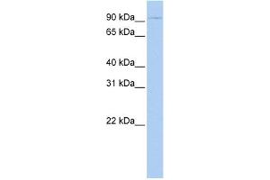 WB Suggested Anti-TSHR Antibody Titration:  0. (TSH receptor anticorps  (N-Term))