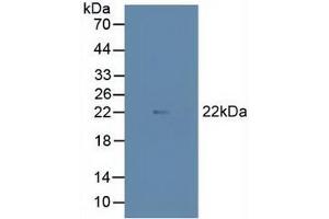 Figure. (MAX anticorps  (AA 2-160))
