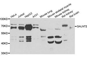 Western blot analysis of extracts of various cell lines, using GALNT2 antibody. (GALNT2 anticorps)