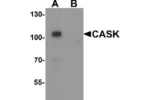 Western blot analysis of CASK in mouse brain tissue lysate with CASK antibody at 1 µg/mL in (A) the absence and (B) the presence of blocking peptide. (CASK anticorps  (N-Term))