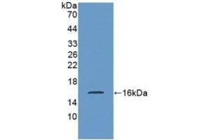 Detection of Recombinant SST, Rat using Polyclonal Antibody to Somatostatin (SST)