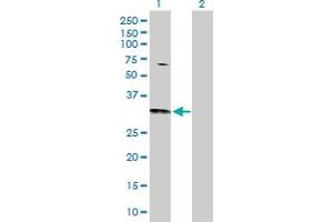 Western Blot analysis of CDC42 expression in transfected 293T cell line by CDC42 MaxPab polyclonal antibody. (CDC42 anticorps  (AA 1-191))
