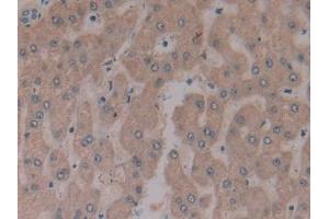 Detection of MFAP2 in Human Liver Tissue using Polyclonal Antibody to Microfibrillar Associated Protein 2 (MFAP2)