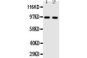 Anti-TLR4 antibody, Western blotting Lane 1: HELA Cell Lysate  Lane 2: SMMC Cell Lysate (TLR4 anticorps  (N-Term))