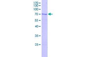 Image no. 1 for Chromosome 4 Open Reading Frame 49 (C4orf49) (AA 1-240) protein (GST tag) (ABIN4369909)