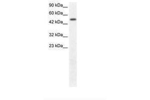 anti-FLT3-Interacting Zinc Finger 1 (FIZ1) (AA 362-411) antibody
