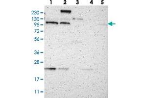 Western blot analysis of Lane 1: RT-4, Lane 2: U-251 MG, Lane 3: Human Plasma, Lane 4: Liver, Lane 5: Tonsil with TMF1 polyclonal antibody  at 1:250-1:500 dilution. (TMF1 anticorps)